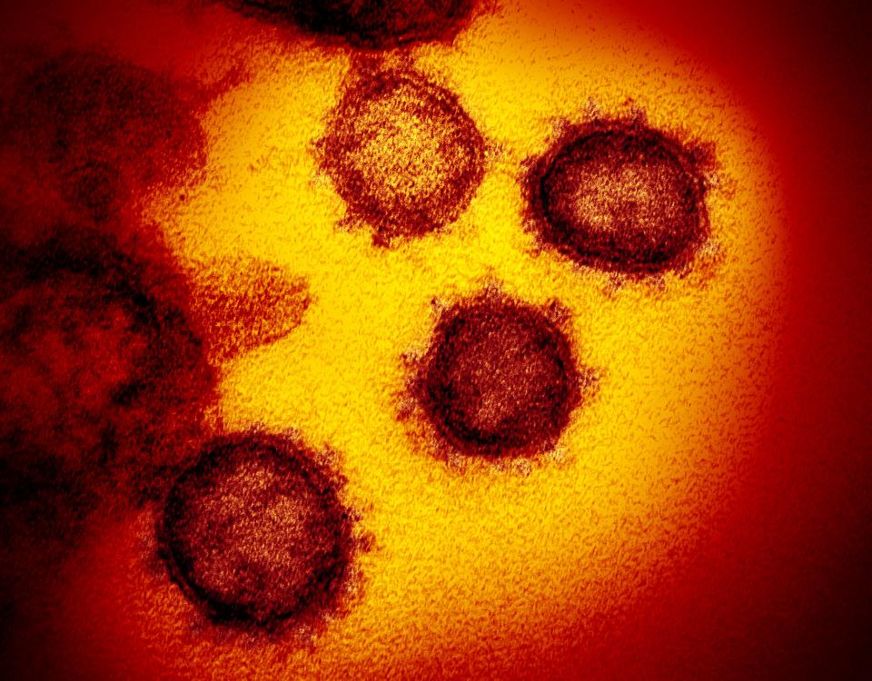 Free download high resolution image - free image free photo free stock image public domain picture  COVID-19 virus Coronavirus disease